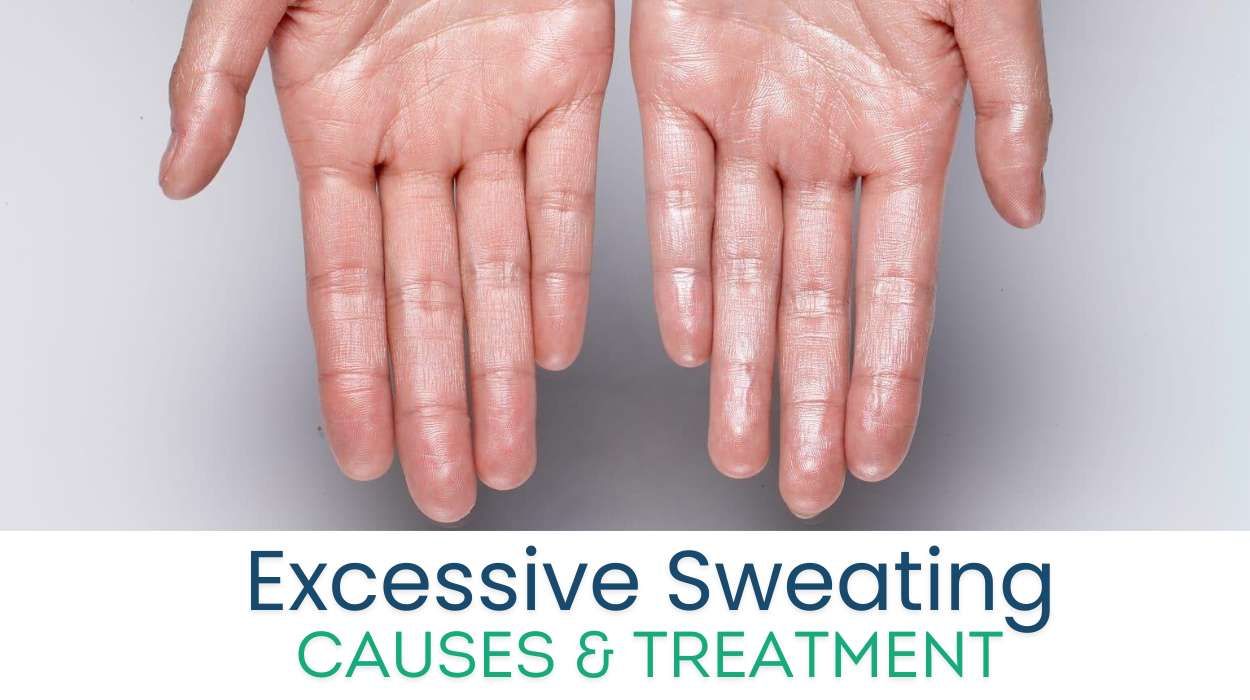 Excessive Sweating (Hyperhidrosis) Treatment - Dermatology treatment by Dr. Rohit Gupta in Birgunj