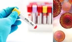Comprehensive STI/STD Screening & Management - Dermatology treatment by Dr. Rohit Gupta in Birgunj