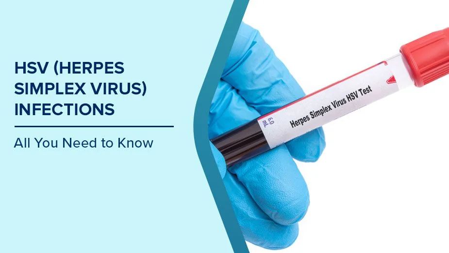 Genital Herpes (HSV) Management & Suppression - Dermatology treatment by Dr. Rohit Gupta in Birgunj