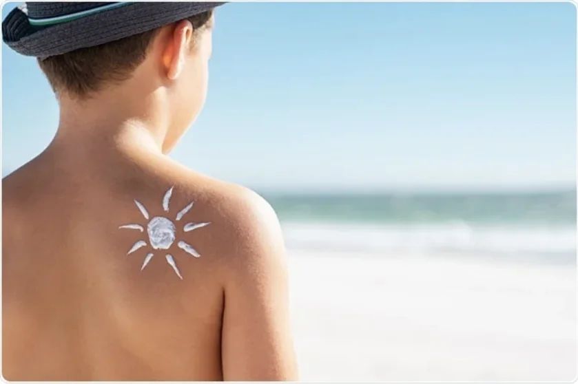सनस्क्रिन लगाउँदा हामी गर्ने सामान्य गल्तीहरू — र सही तरिका के हो? - Dr. Rohit Gupta Dermatologist Blog