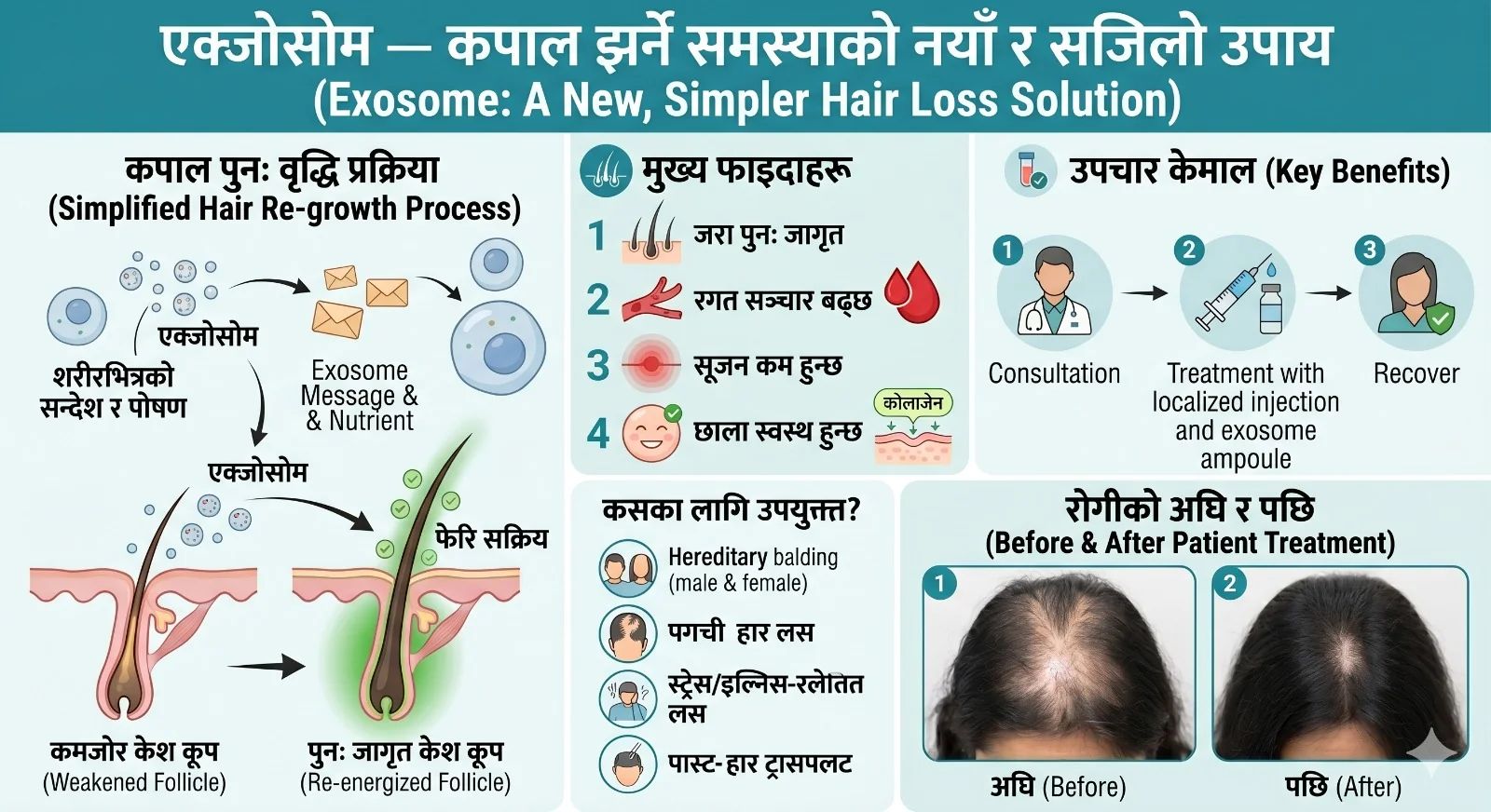 एक्सोसोम थेरापी (Exosome Therapy) — कपाल झर्ने समस्याको क्रान्तिकारी उपचार - Dr. Rohit Gupta Dermatologist Blog